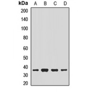 LifeSab™ NACA1 Rabbit pAb (50 µl)
