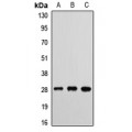 LifeSab™ ETHE1 Rabbit pAb (50 µl)