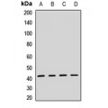 LifeSab™ TSLPR Rabbit pAb (50 µl)