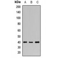 LifeSab™ PDX1 Rabbit pAb (50 µl)