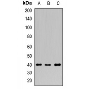LifeSab™ PDX1 Rabbit pAb (50 µl)