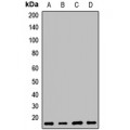 LifeSab™ MAGP1 Rabbit pAb (50 µl)