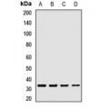 LifeSab™ CTP Rabbit pAb (50 µl)