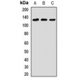 LifeSab™ SNF2L Rabbit pAb (50 µl)