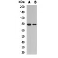 LifeSab™ L3MBTL2 Rabbit pAb (50 µl)