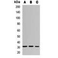 LifeSab™ MMACHC Rabbit pAb (50 µl)
