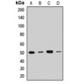 LifeSab™ DDX47 Rabbit pAb (50 µl)