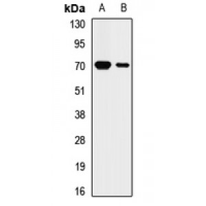 LifeSab™ KRT2 Rabbit pAb (50 µl)