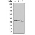 LifeSab™ CNDP2 Rabbit pAb (50 µl)