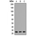 LifeSab™ RAB27B Rabbit pAb (50 µl)