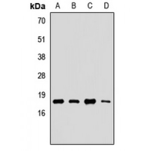 LifeSab™ UBE2G2 Rabbit pAb (50 µl)