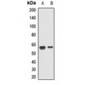 LifeSab™ LMAN1 Rabbit pAb (50 µl)