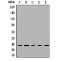 LifeSab™ STX2 Rabbit pAb (50 µl)