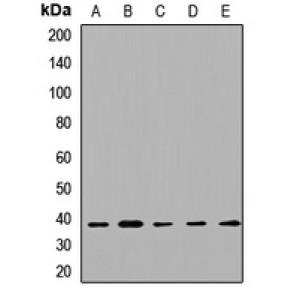 LifeSab™ STX2 Rabbit pAb (50 µl)