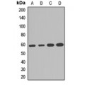 LifeSab™ PGDH3 Rabbit pAb (50 µl)