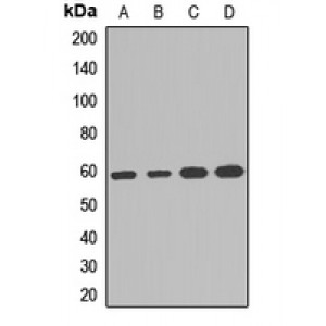 LifeSab™ PGDH3 Rabbit pAb (50 µl)