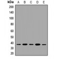 LifeSab™ JMJD8 Rabbit pAb (50 µl)