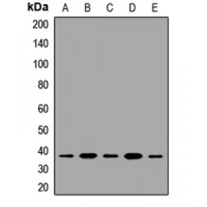 LifeSab™ JMJD8 Rabbit pAb (50 µl)