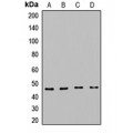 LifeSab™ CPB1 Rabbit pAb (50 µl)