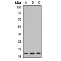 LifeSab™ UBE2N Rabbit pAb (50 µl)