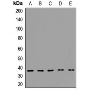 LifeSab™ GIPC Rabbit pAb (50 µl)