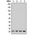 LifeSab™ SEC11A Rabbit pAb (50 µl)