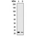 LifeSab™ RAB13 Rabbit pAb (50 µl)