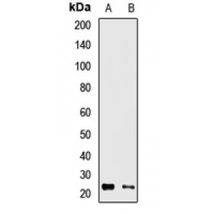 LifeSab™ RAB13 Rabbit pAb (50 µl)