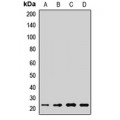 LifeSab™ IL-17C Rabbit pAb (50 µl)