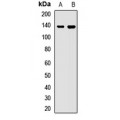 LifeSab™ WDR11 Rabbit pAb (50 µl)