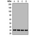 LifeSab™ SRPRB Rabbit pAb (50 µl)