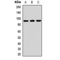 LifeSab™ ACBD5 Rabbit pAb (50 µl)