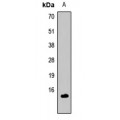 LifeSab™ Cripto 1 Rabbit pAb (50 µl)