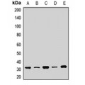 LifeSab™ SDHB Rabbit pAb (50 µl)