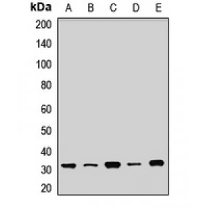 LifeSab™ SDHB Rabbit pAb (50 µl)