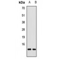 LifeSab™ Transthyretin Rabbit pAb (50 µl)