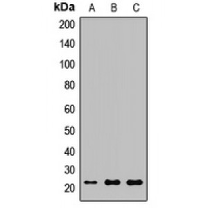 LifeSab™ NGAL Rabbit pAb (50 µl)
