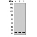 LifeSab™ RAB7A Rabbit pAb (50 µl)