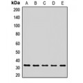 LifeSab™ RSU1 Rabbit pAb (50 µl)