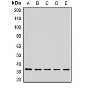LifeSab™ RSU1 Rabbit pAb (50 µl)