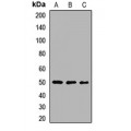 LifeSab™ MAGEA4 Rabbit pAb (50 µl)