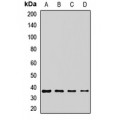 LifeSab™ MC3R Rabbit pAb (50 µl)