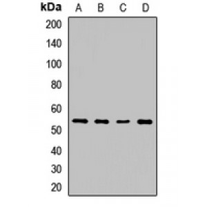 LifeSab™ SPTLC2 Rabbit pAb (50 µl)