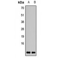 LifeSab™ AKAP7 Rabbit pAb (50 µl)
