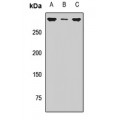 LifeSab™ SETD2 Rabbit pAb (50 µl)