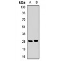 LifeSab™ SPRR3 Rabbit pAb (50 µl)