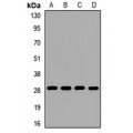LifeSab™ MRPS18B Rabbit pAb (50 µl)