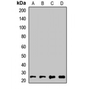 LifeSab™ RAB21 Rabbit pAb (50 µl)