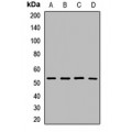 LifeSab™ SCaMC-1 Rabbit pAb (50 µl)