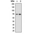 LifeSab™ CDT2 Rabbit pAb (50 µl)
